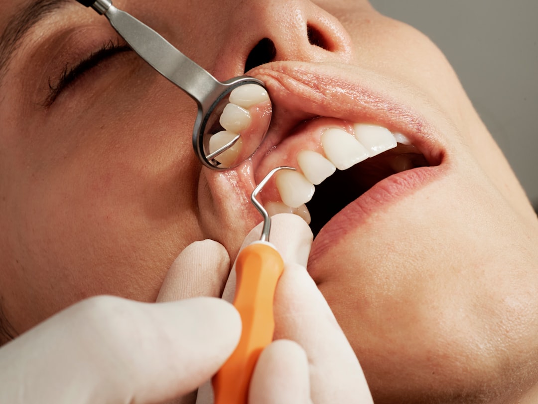 Photo chipped tooth repair Boston