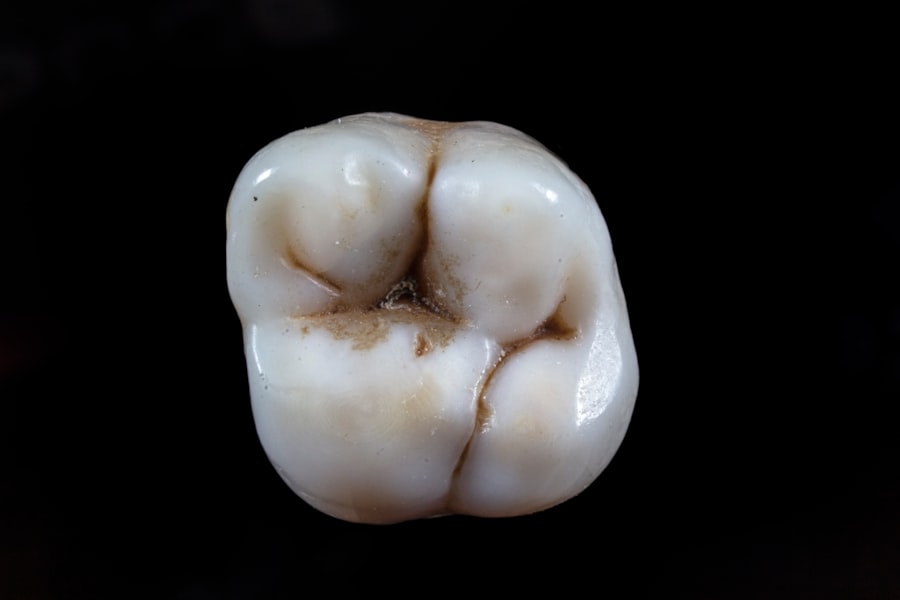 Emergency Cosmetic Dentist in Boston: Get Quick Smile Makeover! Photo cosmetic dentist Boston